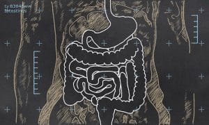 What is leaky gut and why should you care?