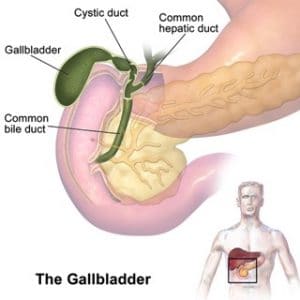 Gluten sensitivity can raise your risk of gallbladder surgery