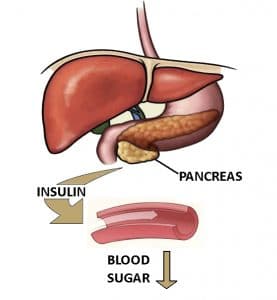 Eating yourself sick: Insulin resistance and disease